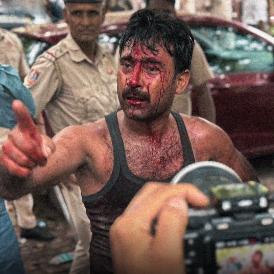 Injured protester with blood on face and hand during clash